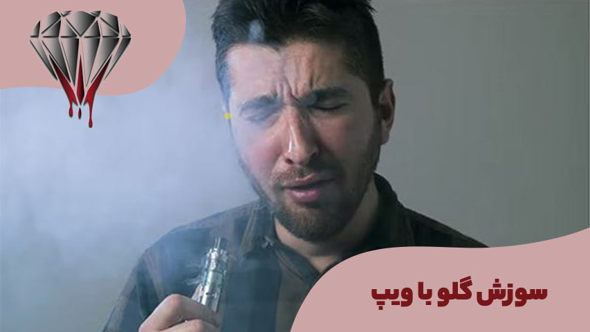 سوزش گلو با ویپ